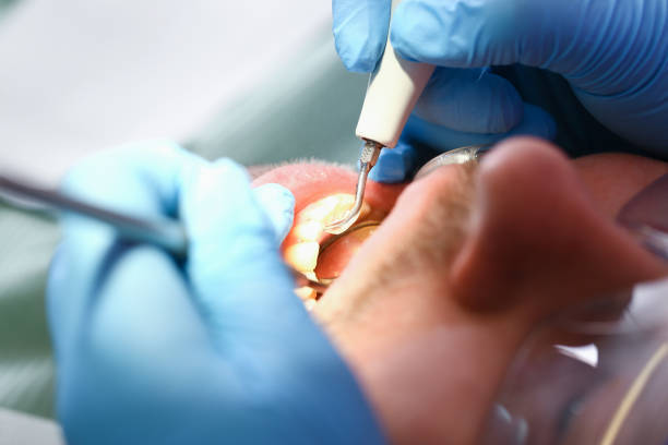 Best Tooth Infection Emergency Dentist  in South Sumter, SC