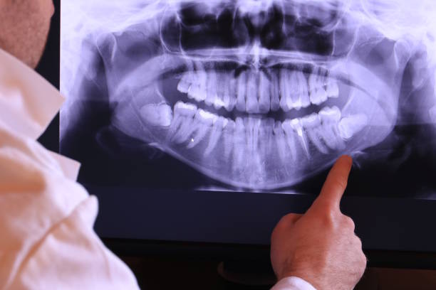 Best Emergency Gum Pain Relief  in South Sumter, SC